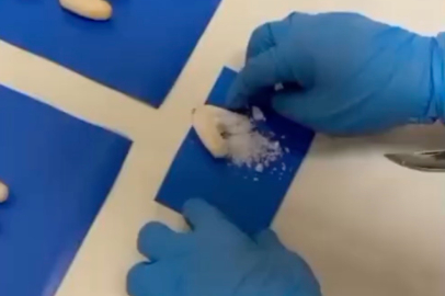 Midesinde 33 paketle yakalandı!