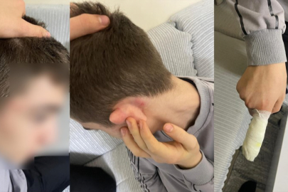 Kuryeler 14 yaşındaki çocuğu tekme tokat dövdüler