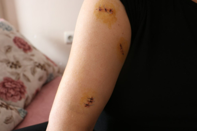 Diyarbakır’da dehşet: Eşini 30 yerinden bıçakladı!